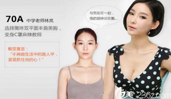 宁波薇琳刘波双平面丰胸案例 宁波薇琳刘波双平面丰胸案例