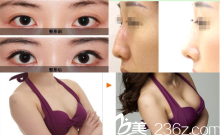 iFace整形外科部分案例 iFace整形外科部分案例