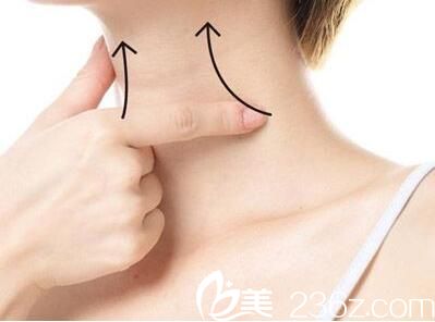 韩国SHE’S整形外科医院颈部除皱