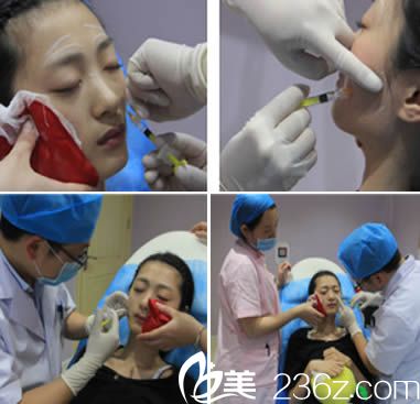 厦门杨主任玻尿酸多部位多层次注射 厦门杨主任玻尿酸多部位多层次注射