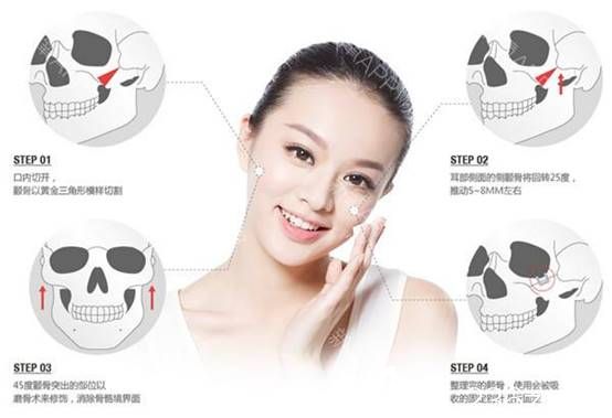 边圣洙院长分享手术过程 边圣洙院长分享手术过程