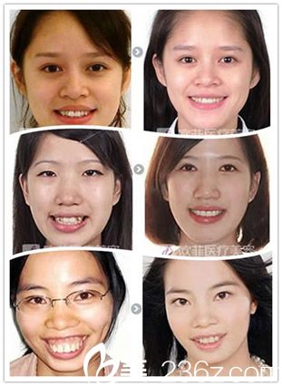 厦门李博医生牙齿整形<span style= 厦门李博医生牙齿整形<span style=