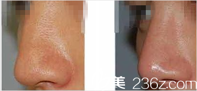 La Foret整形外科案例 La Foret整形外科案例