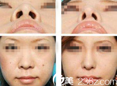 ISTAR整形外科案例 ISTAR整形外科案例