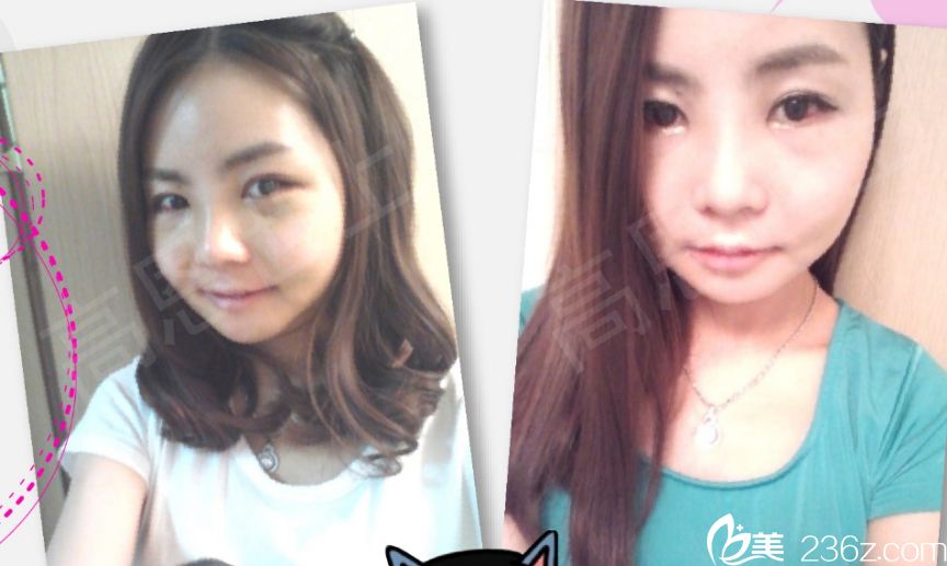 赵胄元院做面部轮廓出名吗 赵胄元院做面部轮廓出名吗