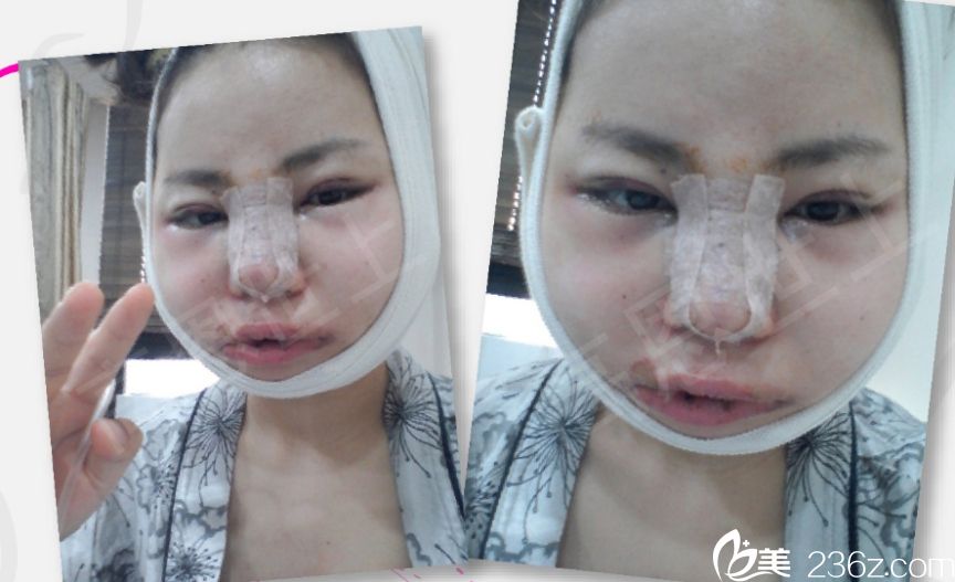 韩国高恩世上赵胄元面部轮廓真人<span style= 韩国高恩世上赵胄元面部轮廓真人<span style=