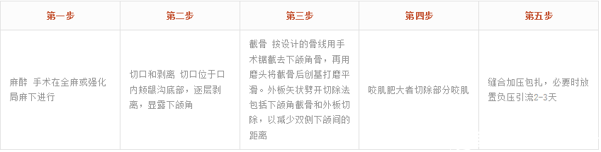崔相錄院长V-LINE手术过程 崔相錄院长V-LINE手术过程