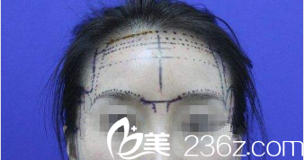 ISTAR整形外科案例 ISTAR整形外科案例