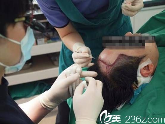 金大溶院长毛发移植手术过程
