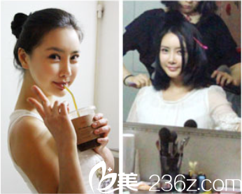 申承翰院长面部轮廓案例术后效果 申承翰院长面部轮廓案例术后效果