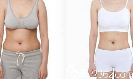 Beauty Line 4U整形外科医院案例 Beauty Line 4U整形外科医院案例