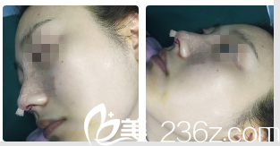 Beauty Line 4U整形外科医院案例