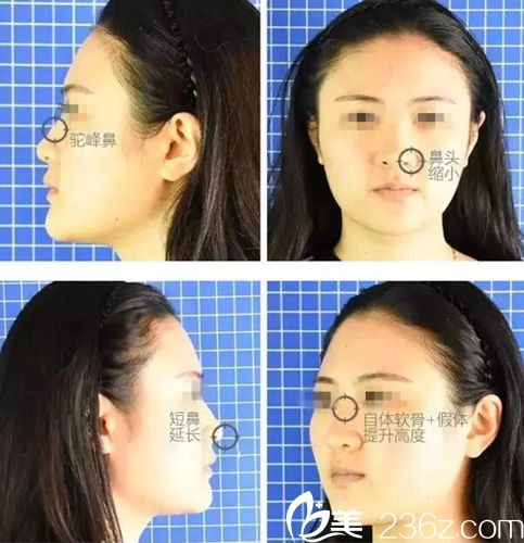 需要解决的项目 需要解决的项目