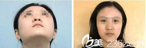 20171229_1514528868304038.jpg QQ截图20171229114943.jpg