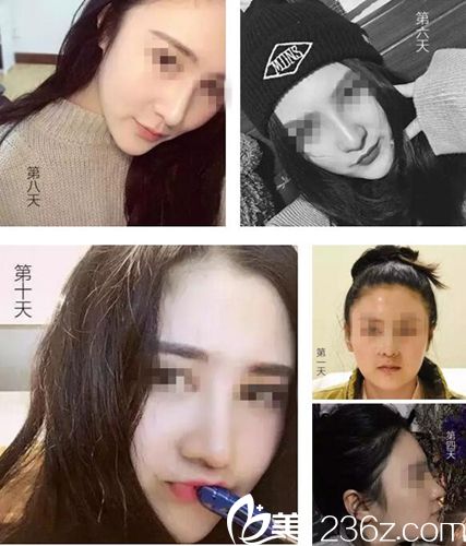 20171229_1514529002911634.jpg QQ截图20171229115019.jpg