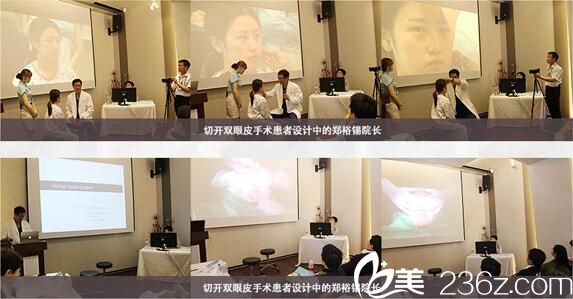 德莱茵整形外科介绍切开双眼皮术 德莱茵整形外科介绍切开双眼皮术