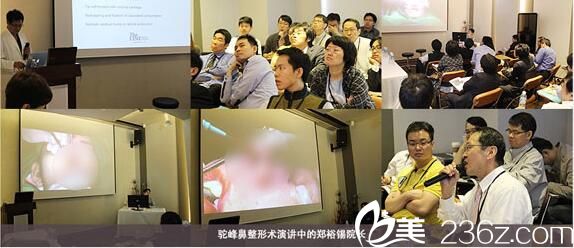 德莱茵整形外科郑裕锡院长讲述驼峰鼻矫正术 德莱茵整形外科郑裕锡院长讲述驼峰鼻矫正术