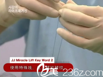 禹政浩院长使用特殊线提拉皱纹 禹政浩院长使用特殊线提拉皱纹