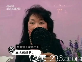 美来可整形医院面部提升术 美来可整形医院面部提升术