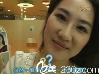 美来可整形医院面部提升术前 美来可整形医院面部提升术前