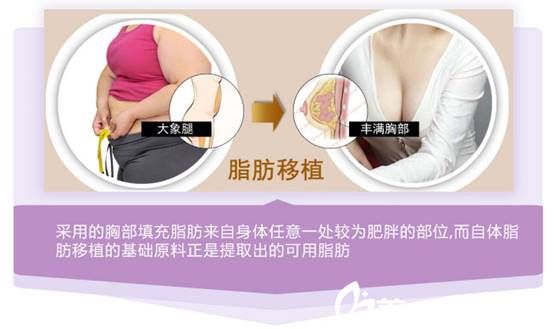 上海伊莱美整形医院自体脂肪丰胸原理
