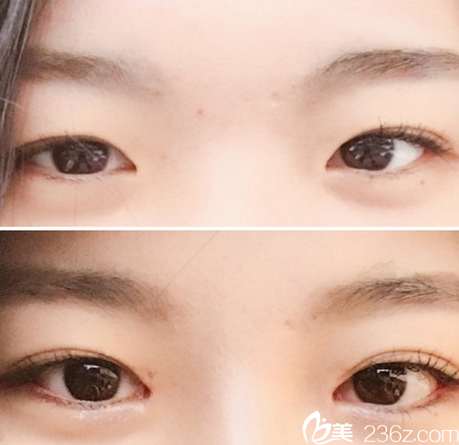 李柱洪院长案例 李柱洪院长案例