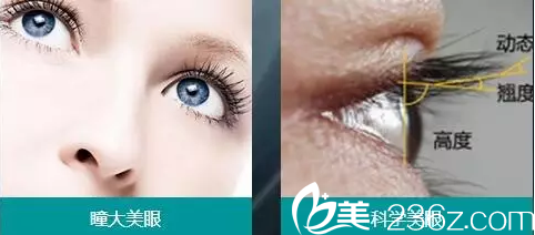 无痕翘睫重睑术简介