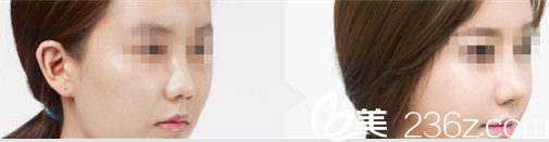 ELLIUM女性医院案例