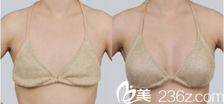 ELLIUM女性医院案例