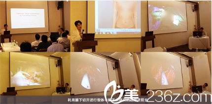 德莱茵整形医院赵熔贤院长参加2014年现场手术研讨会