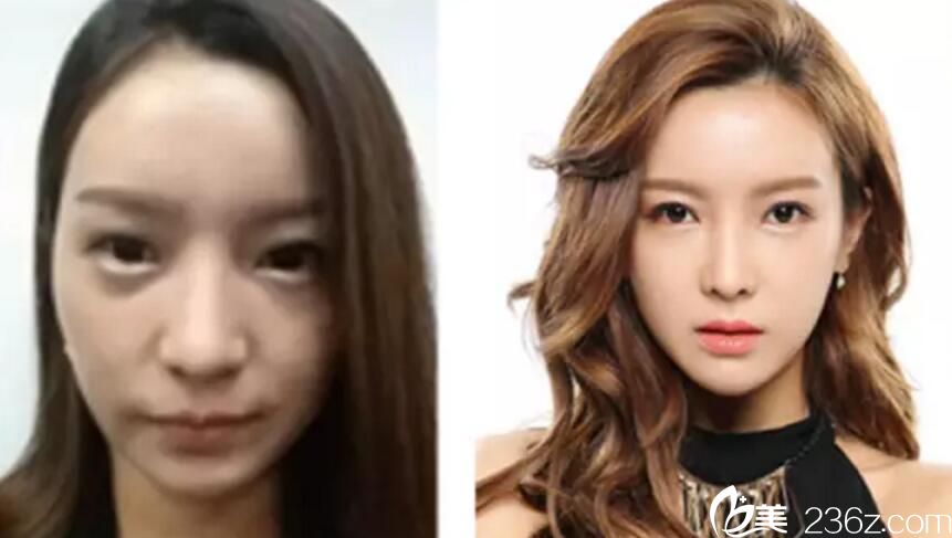 沈炯坤院长打造的案例 沈炯坤院长打造的案例