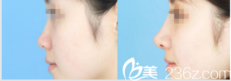 A特整形医院案例 A特整形医院案例