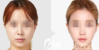 A特整形医院案例