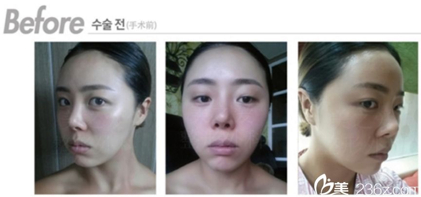 美之爱整形外科沈炯坤院长技术怎么样? 美之爱整形外科沈炯坤院长技术怎么样?