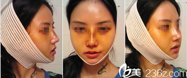 A特整形中心案例