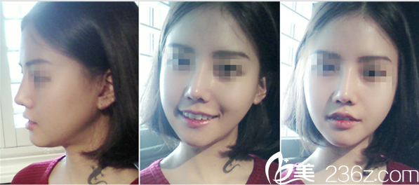 A特整形中心案例