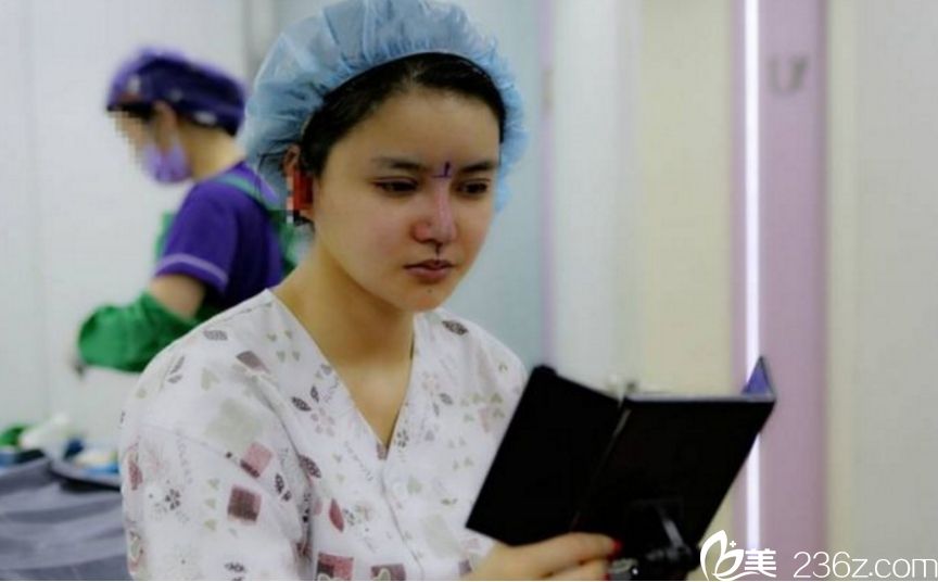 隆鼻手术后确认鼻型 隆鼻手术后确认鼻型