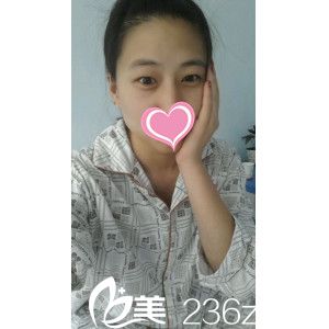 术前肿眼泡小眼睛 术前肿眼泡小眼睛