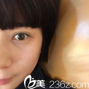 做双眼皮20天恢复情况 做双眼皮20天恢复情况