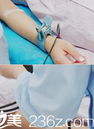 贵阳华美整形鼻综合案例 贵阳华美整形鼻综合案例