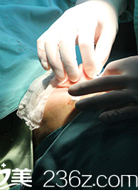 <!--<i data=20240703-sp></i>-->医生手术 <!--<i data=20240703-sp></i>-->医生手术