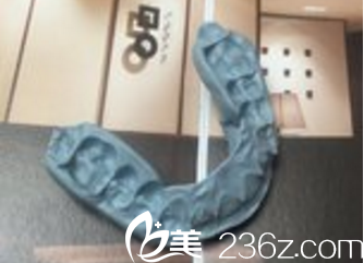 美尔韩医院颜面矫正量身定制矫正器 美尔韩医院颜面矫正量身定制矫正器