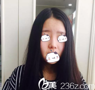 重庆美仑美奂整形施问国院长综合隆鼻术前 重庆美仑美奂整形施问国院长综合隆鼻术前