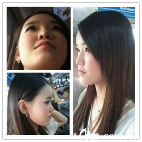 泉州欧菲王伟韬主任丰下巴前 泉州欧菲王伟韬主任丰下巴前