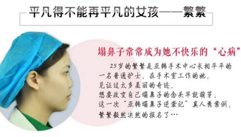 那么吴蒙医生做鼻整形手术到底怎么样 那么吴蒙医生做鼻整形手术到底怎么样