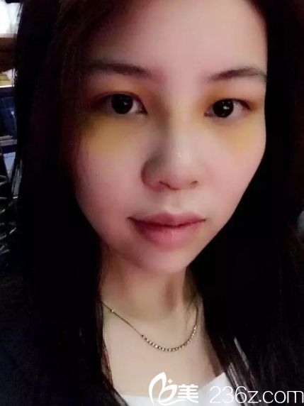 长沙亚韩医学美容和长沙爱思特哪个医院好 长沙亚韩医学美容和长沙爱思特哪个医院好