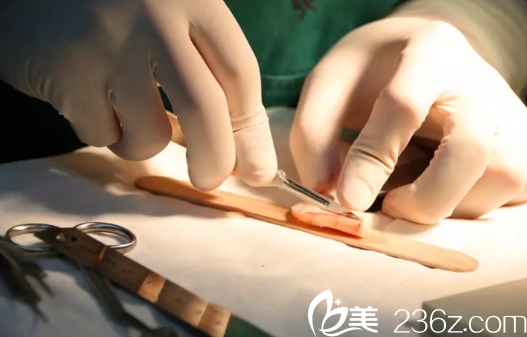 肋软骨鼻尖雕刻 肋软骨鼻尖雕刻