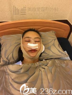 韩国美迪莹整形真人案例2 韩国美迪莹整形真人案例2