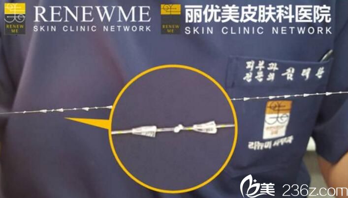 童颜铃铛线 童颜铃铛线