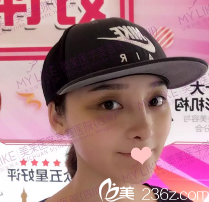 隆鼻7天后的恢复情况 隆鼻7天后的恢复情况